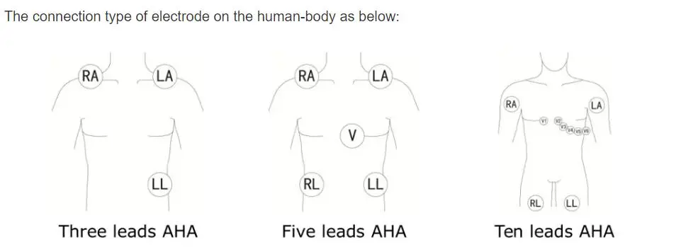 5-लीड ईसीजी फिलीप्स डिजिट्रा प्लस 24 घंटे होल्टर 3100 ए, 5-लीड, स्नैप के लिए लीड करता है